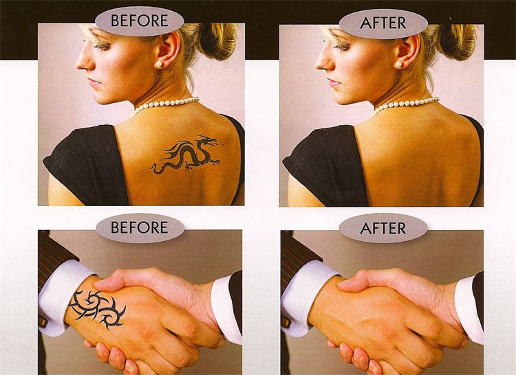 Tatoo Cover Up